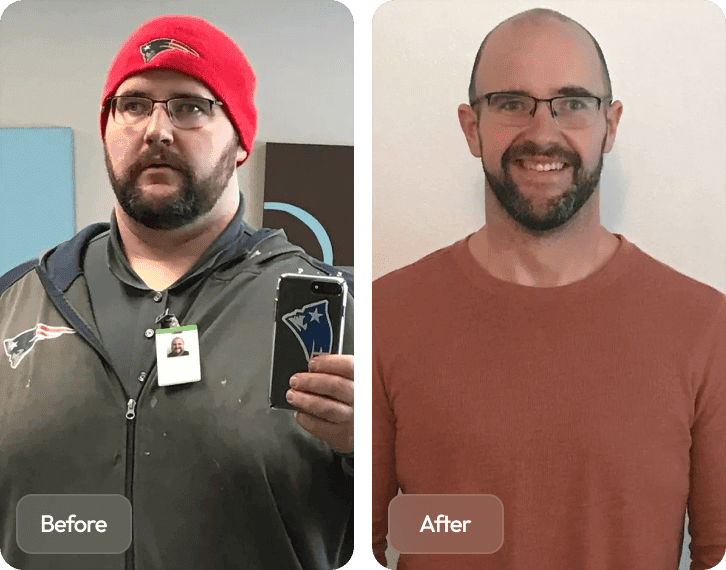 what time of day should you take tirzepatide Cost of Mounjaro for Weight Loss in Northridge Los Angeles CA